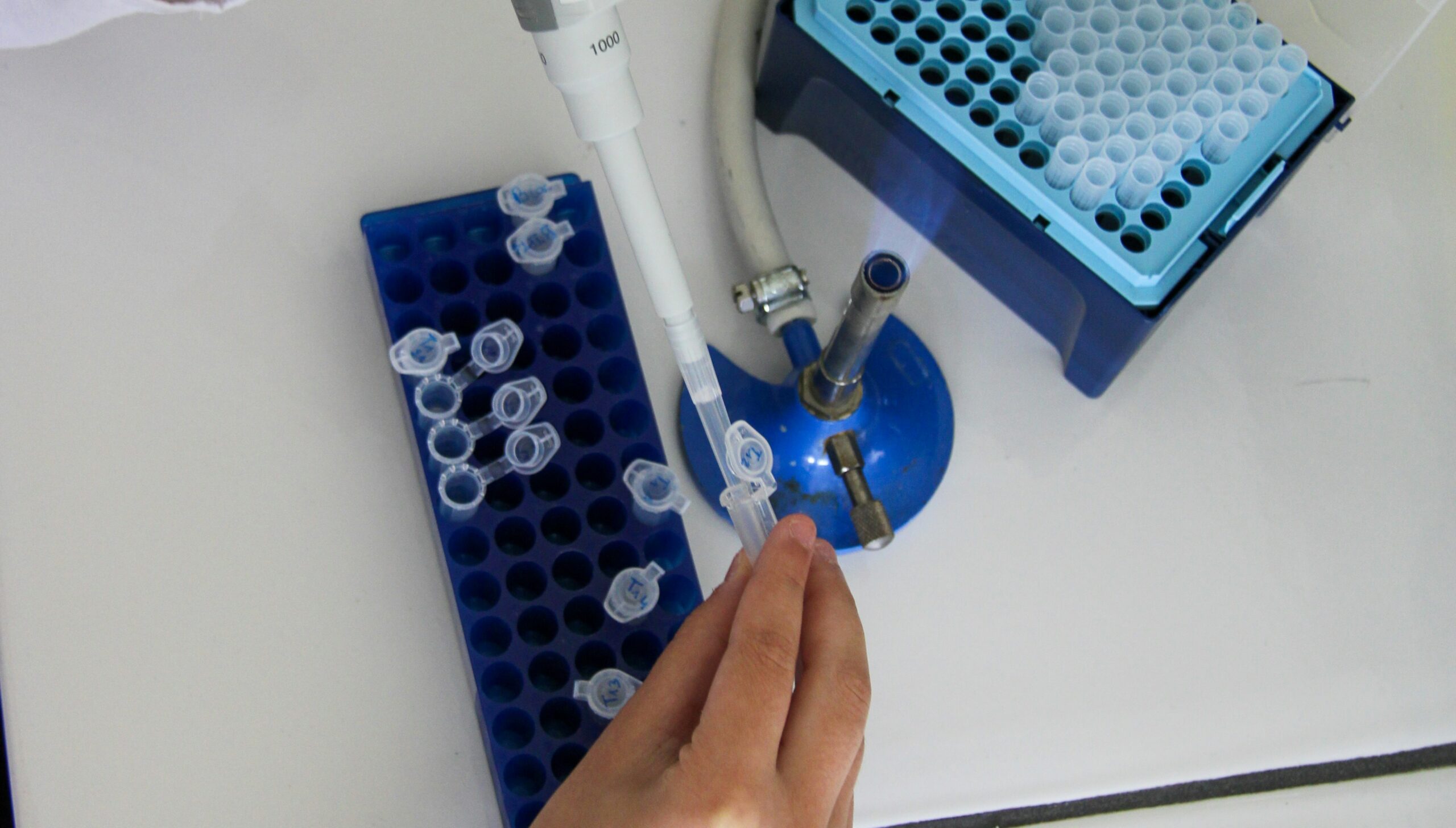 Wearable Devices and Digital Biomarkers: A Pivotal Role in Early Detection and Longitudinal Monitoring of Neurodegenerative Diseases